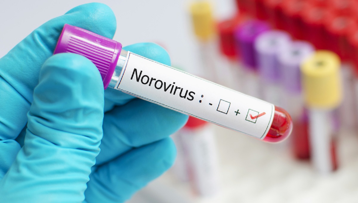 dreamstime_norovirus gastro illness food poisoning